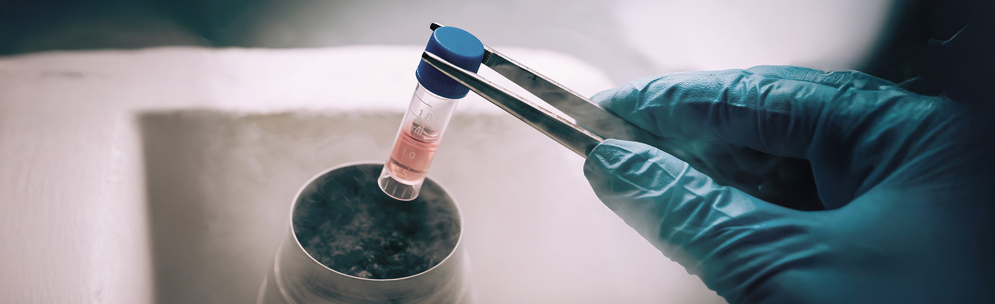 Fertility preservation options